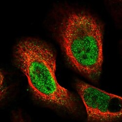 BICRAL Antibody, Novus Biologicals 0.1mL; Unlabeled:Antibodies, Polyclonal